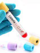 listeria1